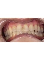 【歯・口内フェチ】「素人人妻マナミさんの超貴重な歯＆口内観察！」マナミ