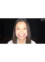 「【歯・口腔フェチ】制服美女 雪奈真冬チャンの超貴重な綺麗な口内&のどちんこ観察!」雪奈真冬