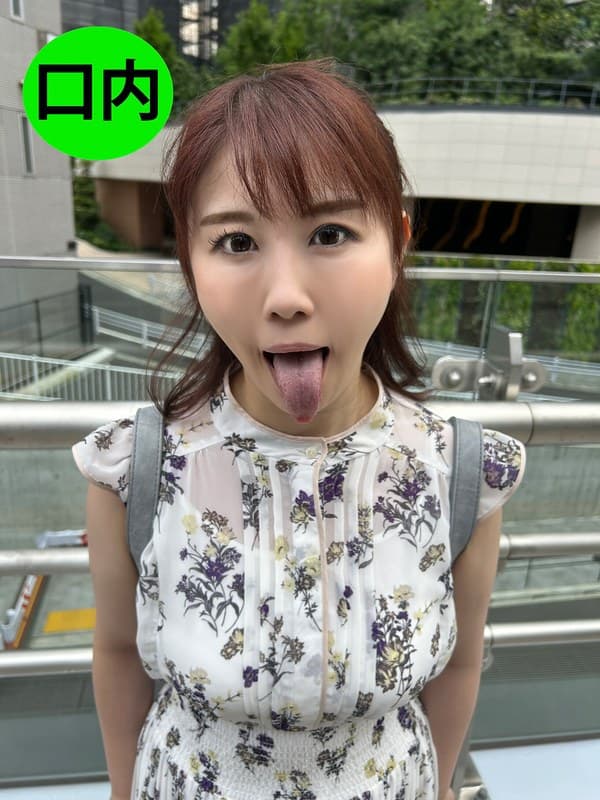 街角で声をかけて口内観察させてもらう スーパーのパート店員 まきさん