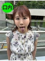 街角で声をかけて口内観察させてもらう スーパーのパート店員 まきさん