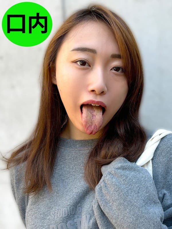 街角で声をかけて口内観察させてもらう 大学生 ゆゆちゃん