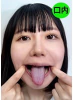 街角で声をかけて口内観察させてもらう テレビ局AD みゆりちゃん