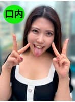 街角で声をかけて口内観察させてもらう アパレル店員 さゆりちゃん