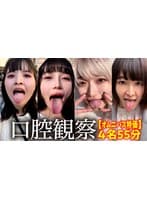 【特価】口腔観察VOL.2 4名55分お買い得セット