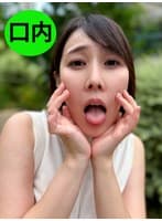 街角で声をかけて口内観察させてもらう WEBデザイナー しおりちゃん